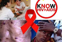 tim hieu ve hiv aids Tìm hiểu những kiến thức cơ bản về căn bệnh thế kỉ, bệnh HIV/AIDS